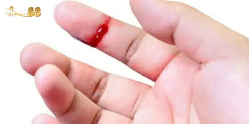 Nằm mơ thấy máu đỏ đánh con số nào giúp bạn trúng lớn?