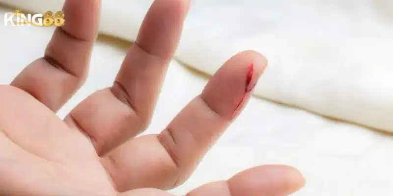 Chia sẻ lời khuyên từ chuyên gia về nằm mơ thấy máu đỏ